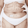 Affordable Liposuction in Thailand: Slim Down Without Breaking the Bank