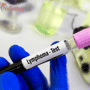 From Diagnosis to Remission: How CAR T-Cell Therapy Fights Lymphoma