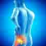 Why Canadians Are Choosing Mexico for Hip Replacement and Knee Surgeries