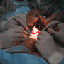 Tendon and Fracture Repair Surgeries in Mexico: Affordable Options for Latin American Patients