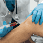 Clifton Michael Lewis Lyles’ Story: Traveling from Lisbon to India for Osteoarthritis Stem Cell Therapy