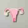 Polycystic Ovary Syndrome (PCOS): Understanding the Condition and Fertility Challenges