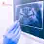 Top Dental Procedures Australians Are Getting Done in Vietnam: All-on-4 Dental Implants Leading the Way