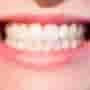 Is It Safe to Get Dental Implants in Costa Rica