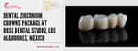 Dental Zirconium Crowns Package at Rose Dental Studio, Los Algodones, Mexico