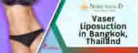 Best Vaser Liposuction Price in Bangkok Thailand