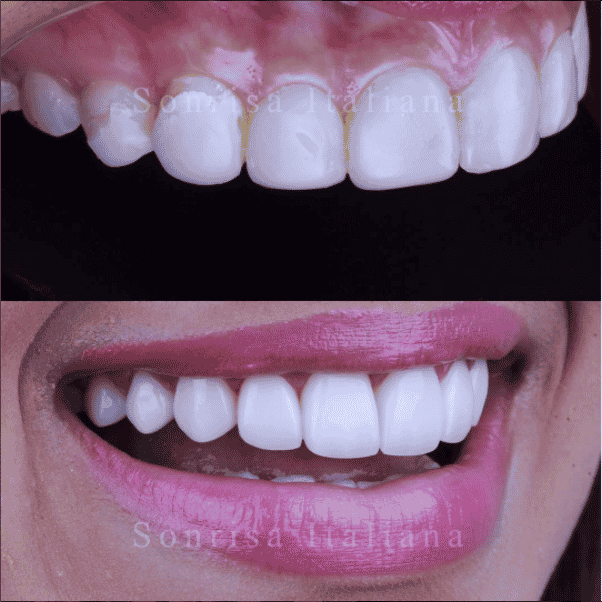 package-slider-img