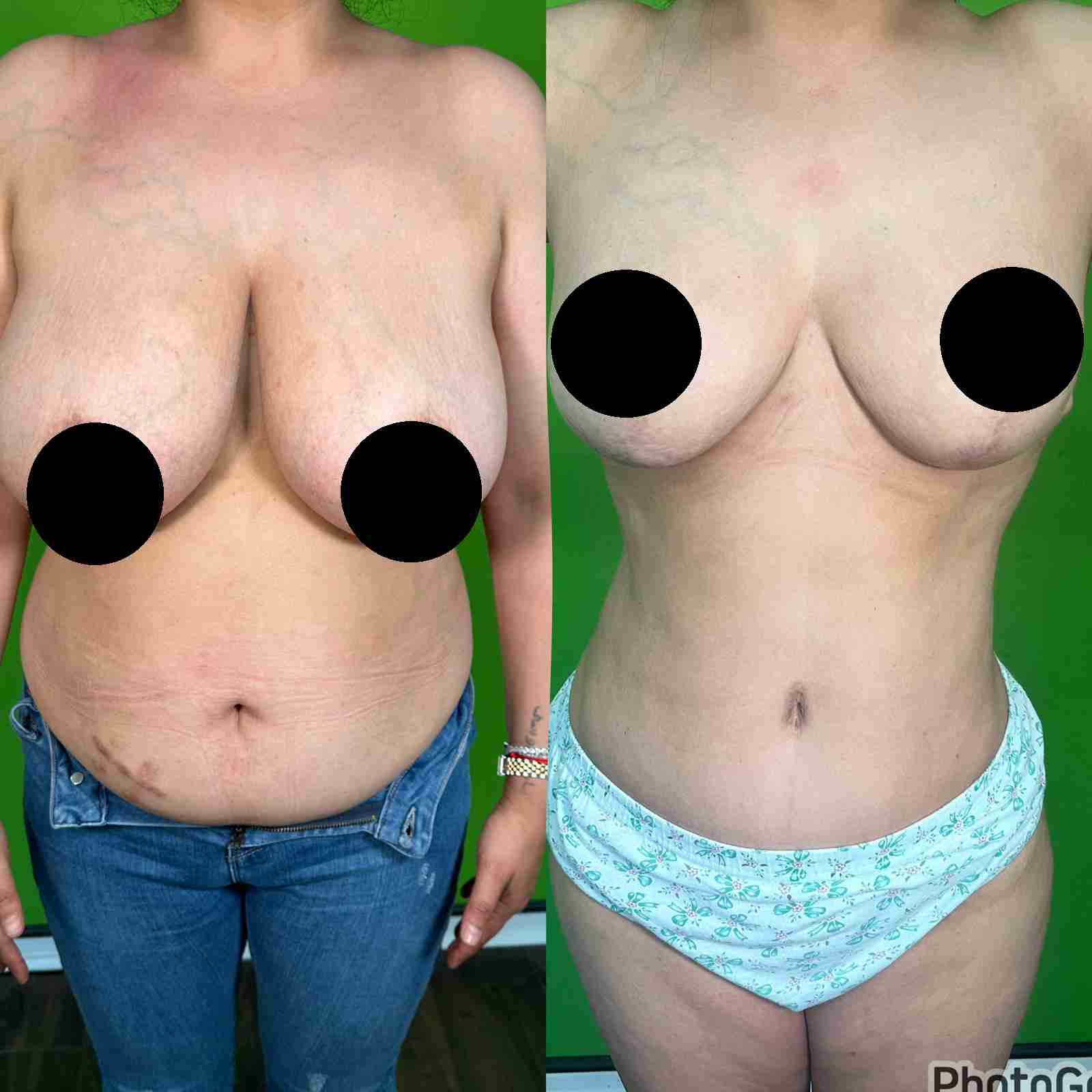 package-slider-img