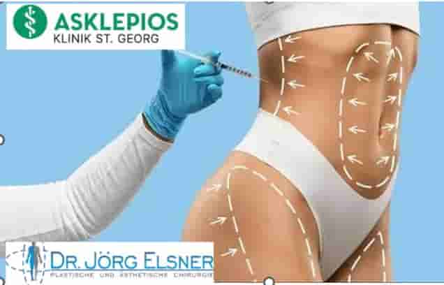 package-slider-img