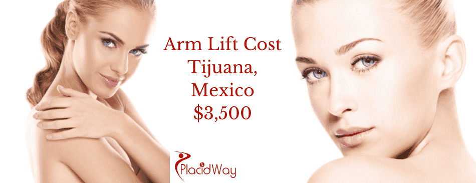 Upper Body Lift – Tijuana, Mexico – San Diego, CA – Breast Lift