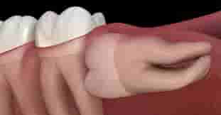 package-slider-img
