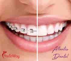 Atlantis Dental Reviews in San Jose, Costa Rica Slider image 4