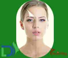 Dermalife Skin and Hair Clinic Reviews from Verified Patients in New Delhi, India Slider image 3