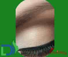 Dermalife Skin and Hair Clinic Reviews from Verified Patients in New Delhi, India Slider image 7