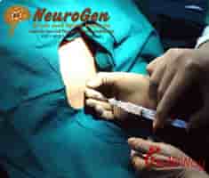 NeuroGen Brain and Spine Institute in Mumbai, India Reviews from Real Patients Slider image 5