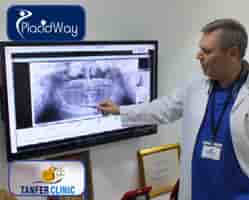 Verified Patient Reviews of Tanfer Clinic in Istanbul, Turkey Slider image 6