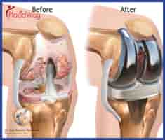 Dr. Jose Manuel  in Puerto Vallarta, Mexico Reviews From Orthopedic Surgery Patients Slider image 6