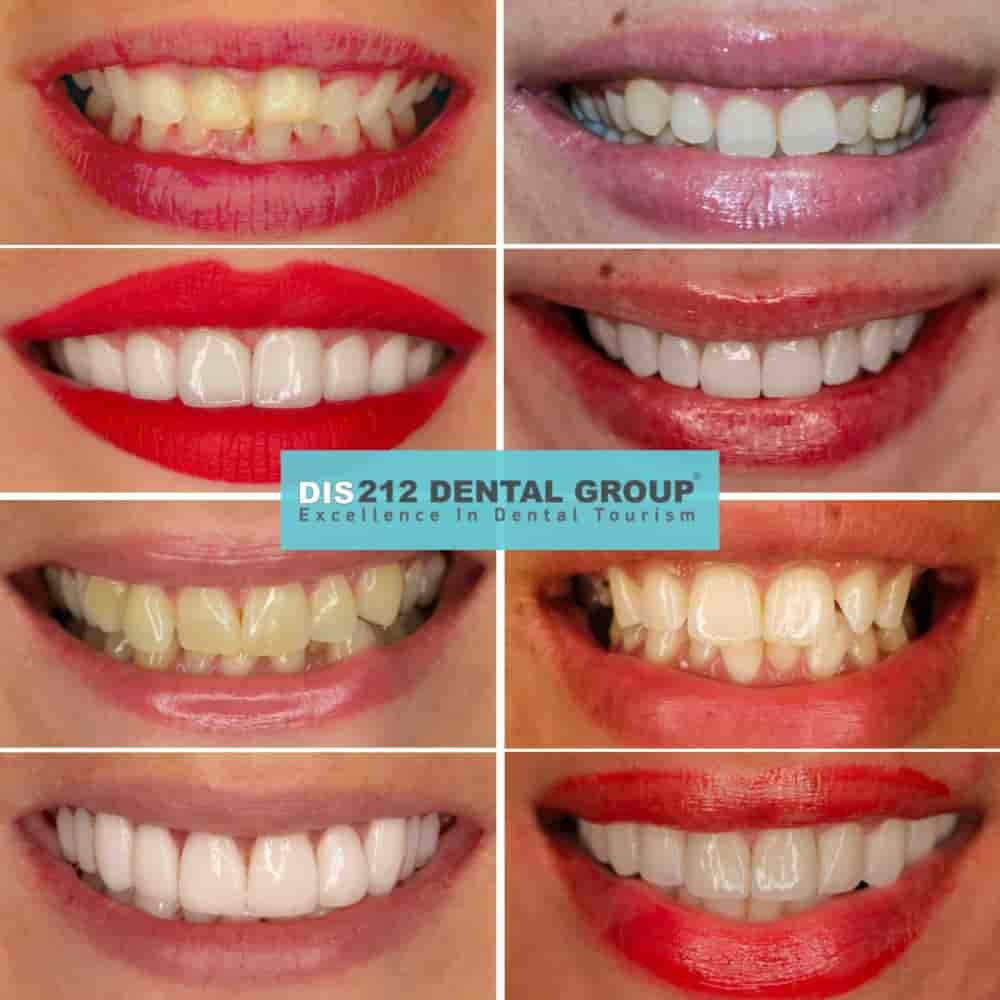 212 Dental Oral and Dental Health Clinic in Istanbul Turkey Reviews from Dental Treatment Patients Slider image 3