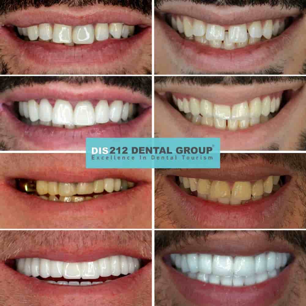 212 Dental Oral and Dental Health Clinic in Istanbul Turkey Reviews from Dental Treatment Patients Slider image 4