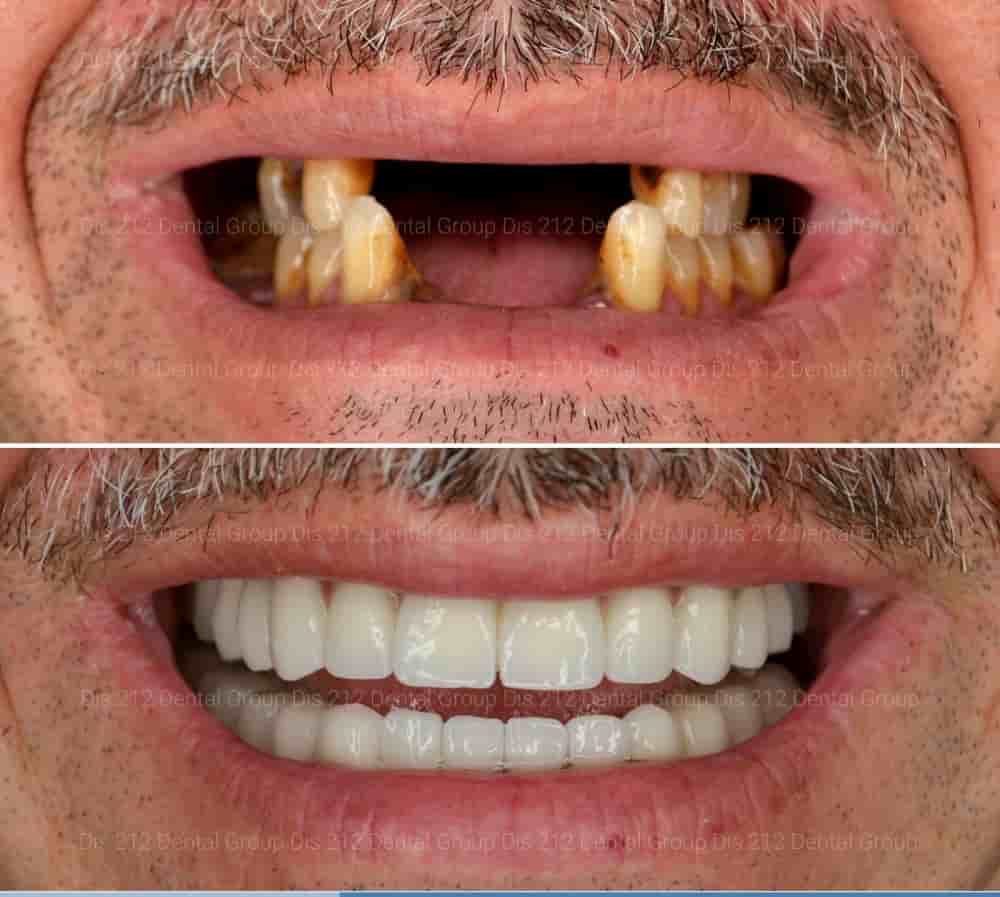 212 Dental Oral and Dental Health Clinic in Istanbul Turkey Reviews from Dental Treatment Patients Slider image 7