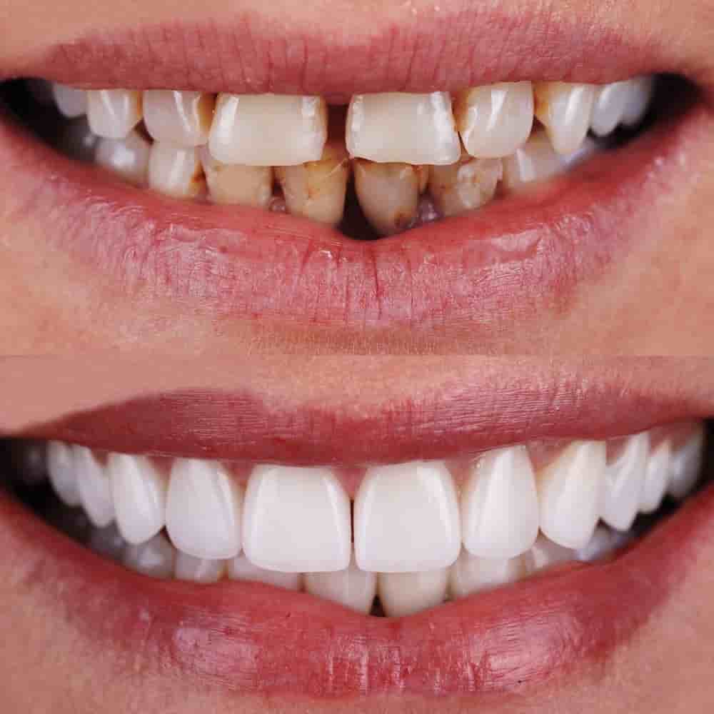 Uzmanlar Dental Clinic Reviews in Istanbul, Turkey Slider image 3