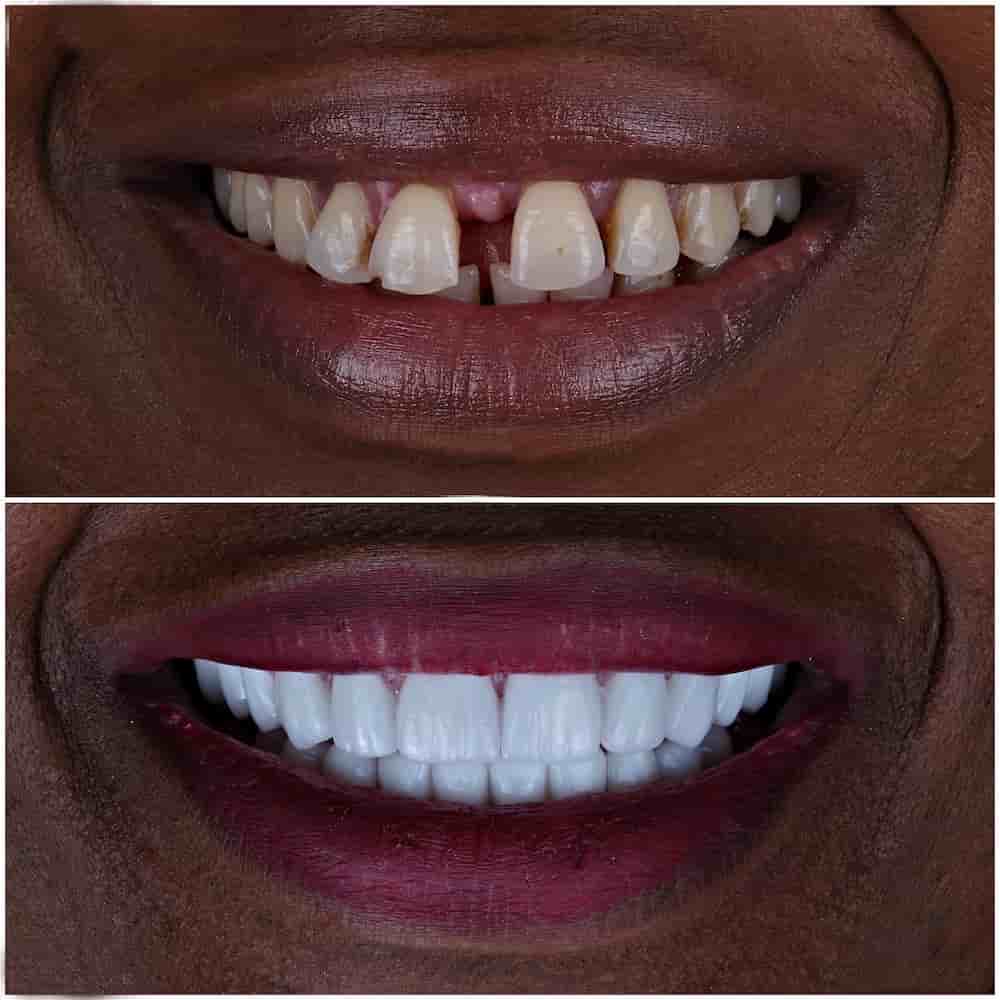 Uzmanlar Dental Clinic Reviews in Istanbul, Turkey Slider image 4