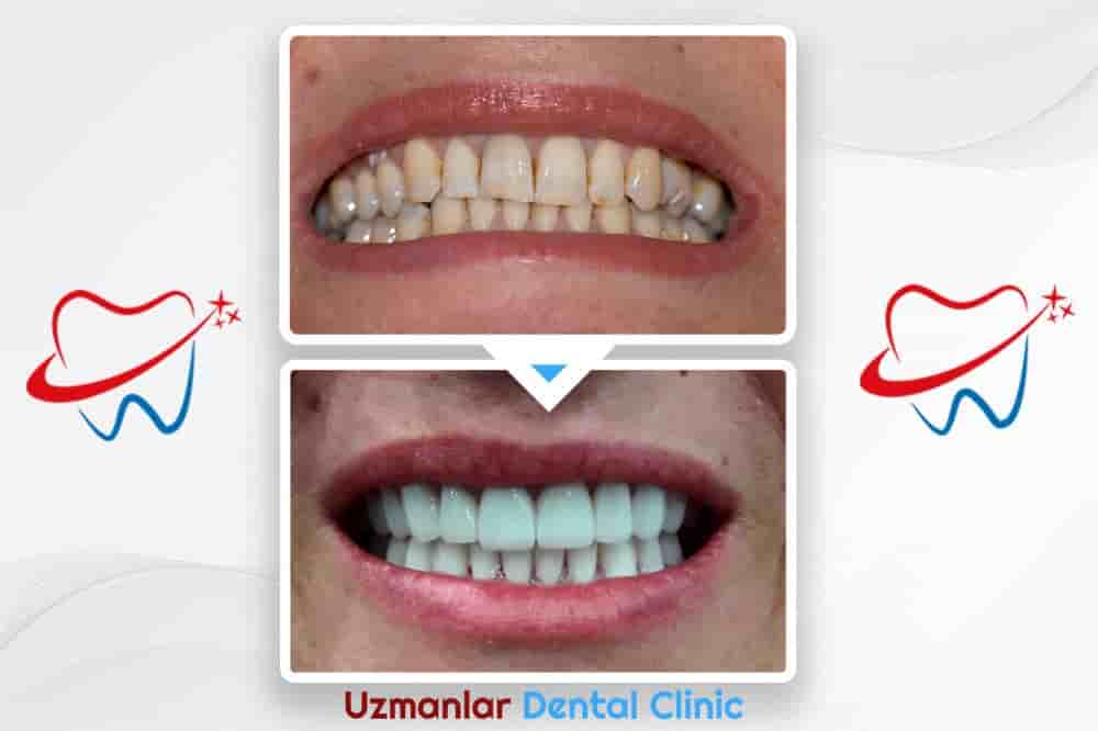 Uzmanlar Dental Clinic Reviews in Istanbul, Turkey Slider image 6