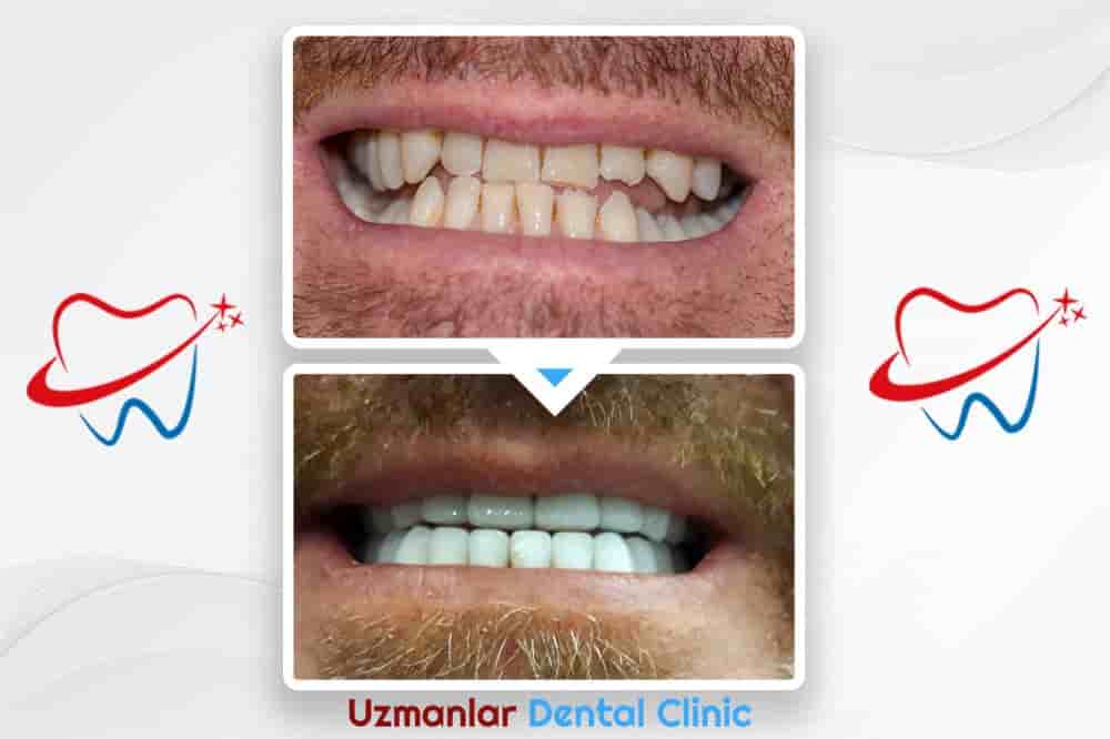 Uzmanlar Dental Clinic Reviews in Istanbul, Turkey Slider image 7