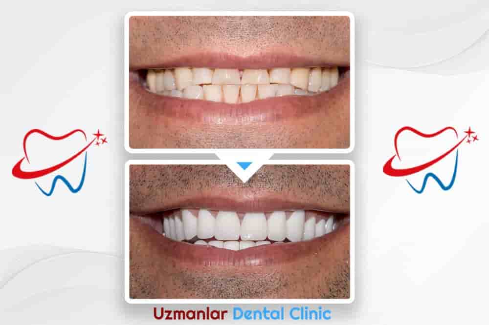 Uzmanlar Dental Clinic Reviews in Istanbul, Turkey Slider image 8