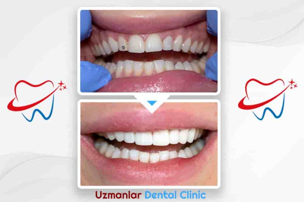 Uzmanlar Dental Clinic Reviews in Istanbul, Turkey Slider image 9