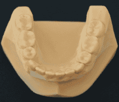 Verified Patient Reviews of GNUX Dental in Cancun, Mexico Slider image 3