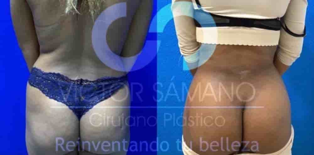 Dr Victor Samano Plastic Surgery Cancun Reviews in Cancun,Playa Del Carmen, Mexico Slider image 9