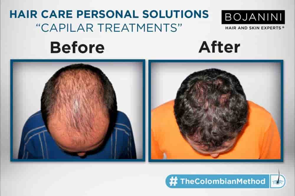 BOJANINI HAIR & SKIN EXPERTS CANC in Cancun, Mexico Reviews from Real Patients Slider image 2