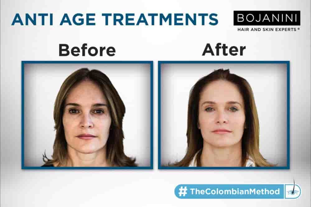 BOJANINI HAIR & SKIN EXPERTS CANC in Cancun, Mexico Reviews from Real Patients Slider image 3