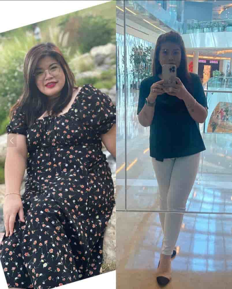 Dr. Islam Abdelkhalek Weight Loss Center Reviews in Alexandria, Egypt Slider image 10