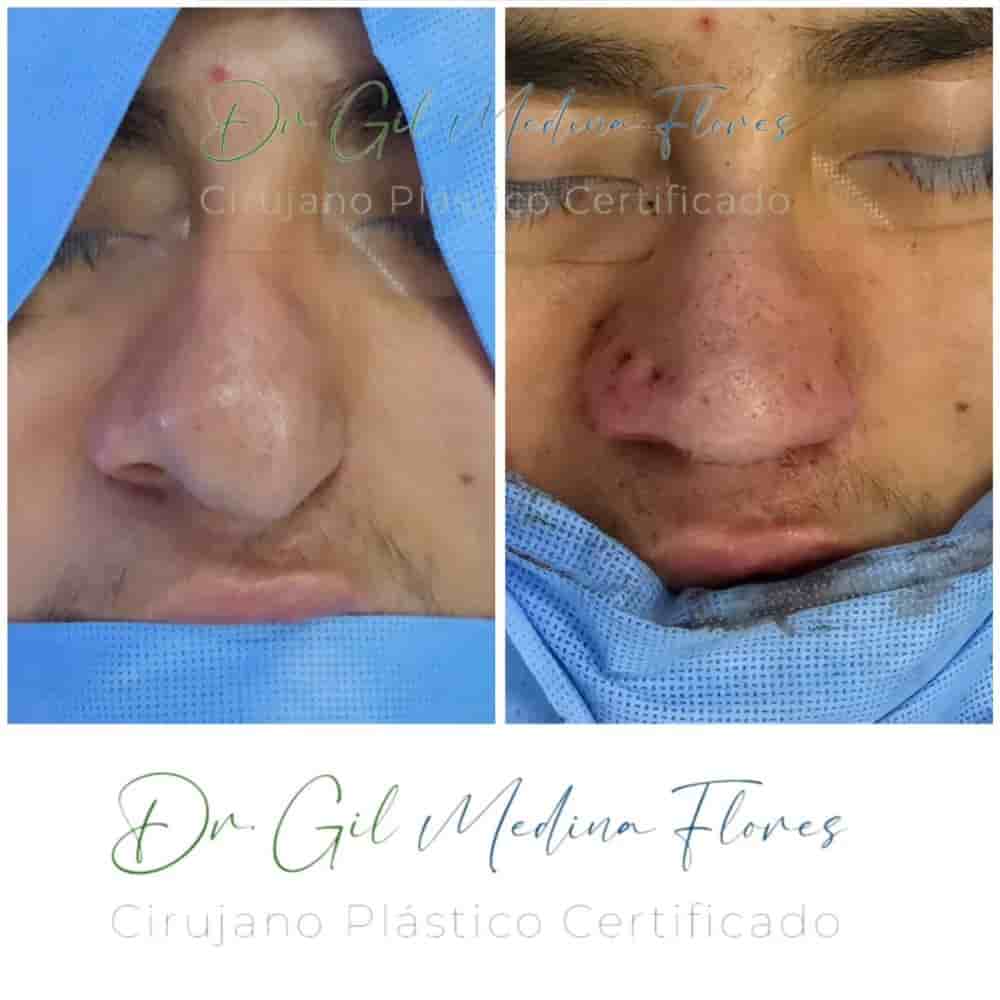 Medina Flores Plastic Surgery in Merida, Mexico Reviews from Real Patients Slider image 2