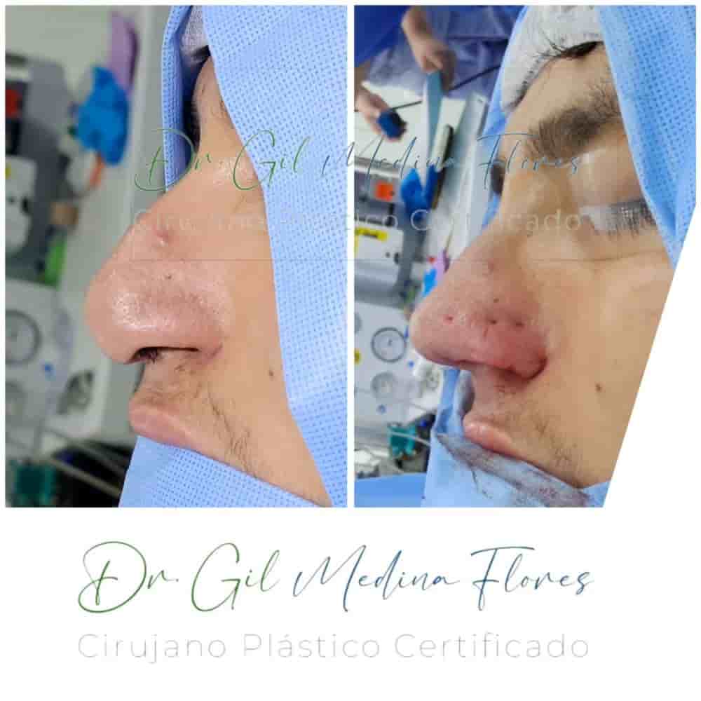 Medina Flores Plastic Surgery in Merida, Mexico Reviews from Real Patients Slider image 5