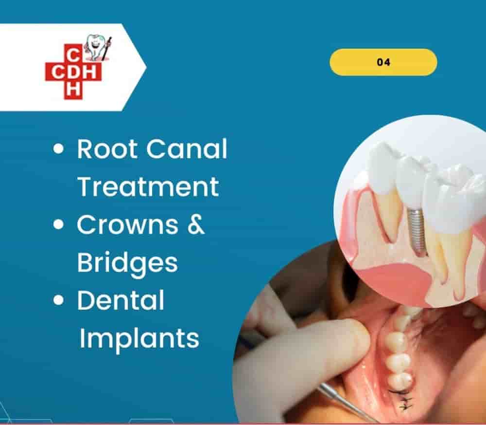 City Dental - Implant Hospital in Rajkot, India Reviews from Real Patients Slider image 3