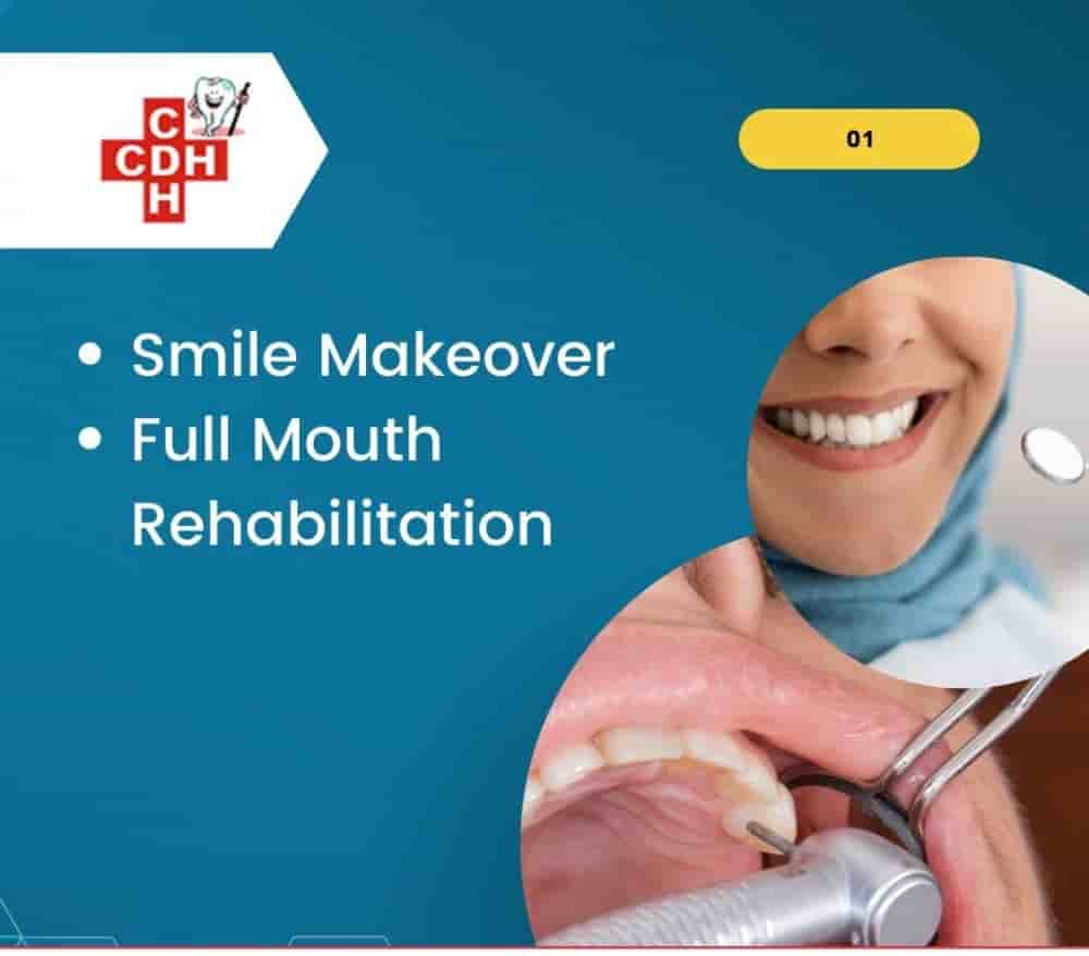 City Dental - Implant Hospital in Rajkot, India Reviews from Real Patients Slider image 6