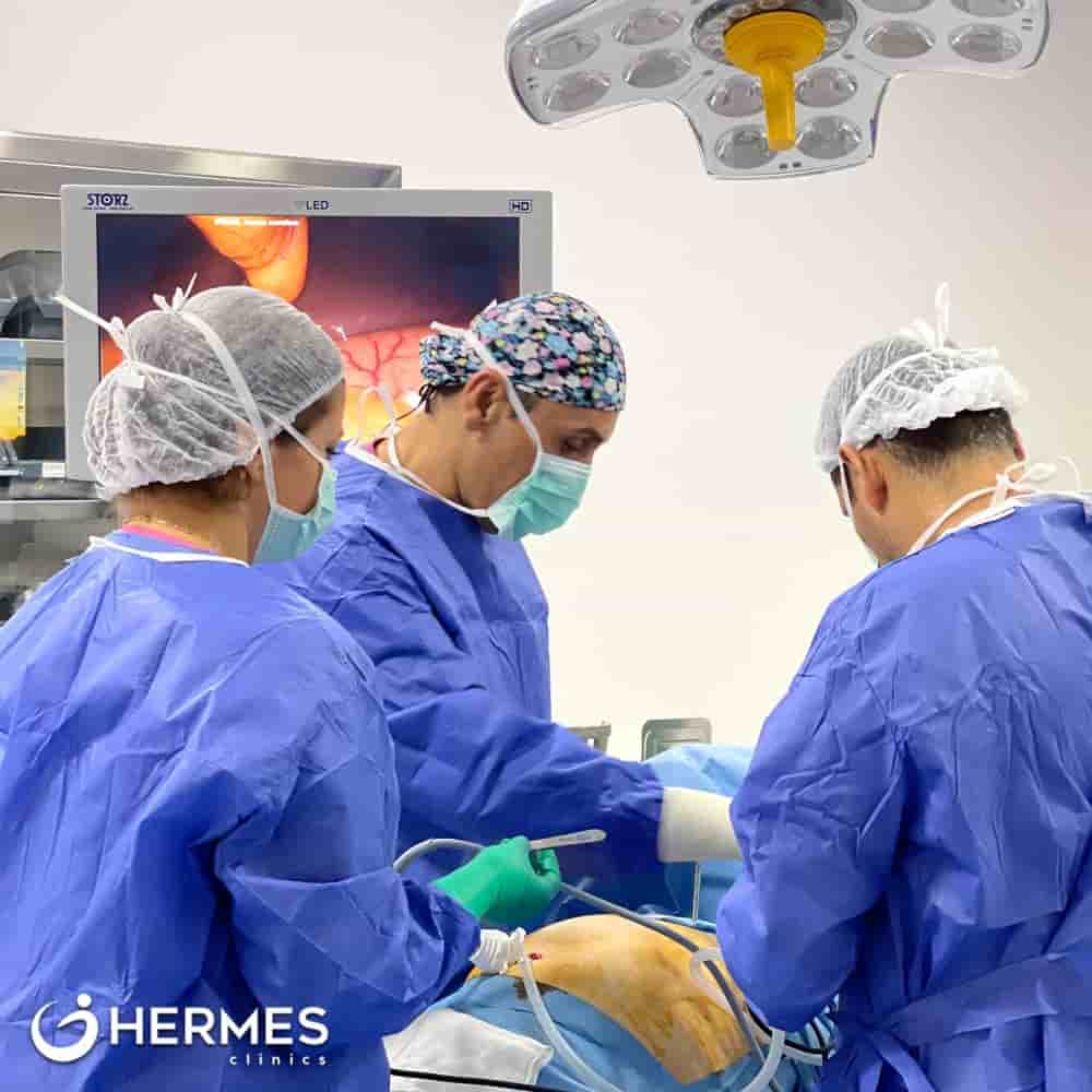Real Patients WLS Reviews at Hermes Clinic Izmir Turkey Slider image 2