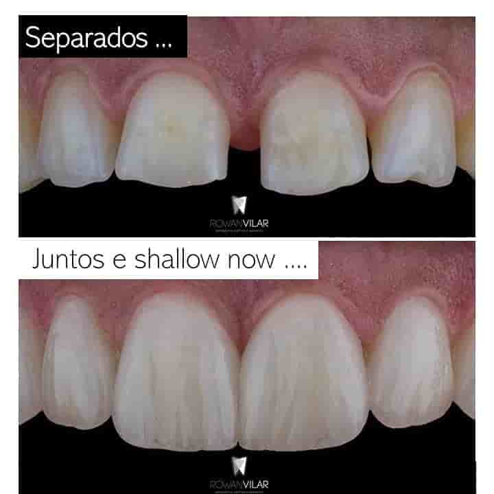 Verified Patient Reviews of Dr. Rowan Vilar - Best Dentist in Rio de Janeiro in Rio de Janeiro, Brazil Slider image 3