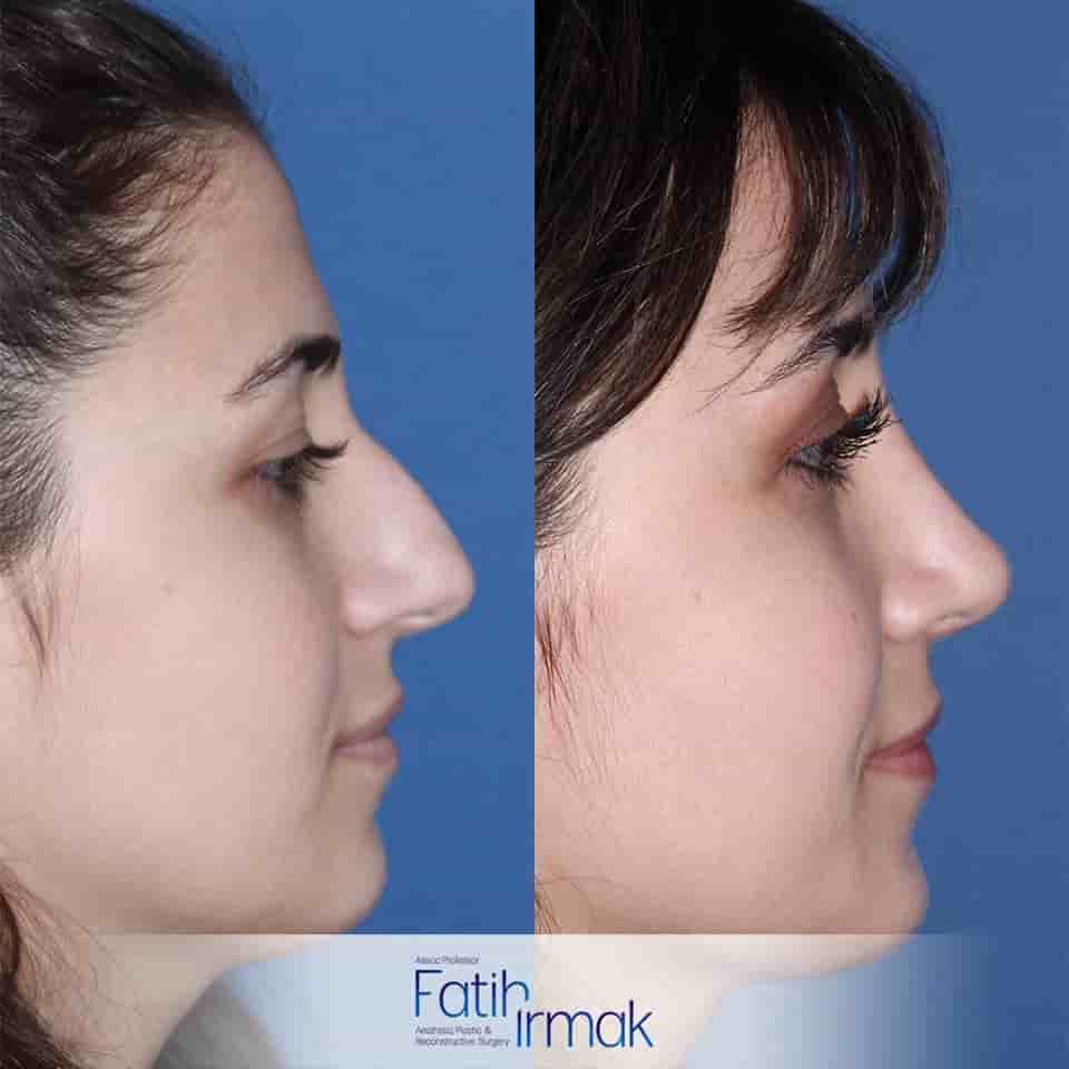 Assoc. Prof. Fatih Irmak Aesthetic and Plastic Surgery Clinic Reviews in Istanbul, Turkey Slider image 3