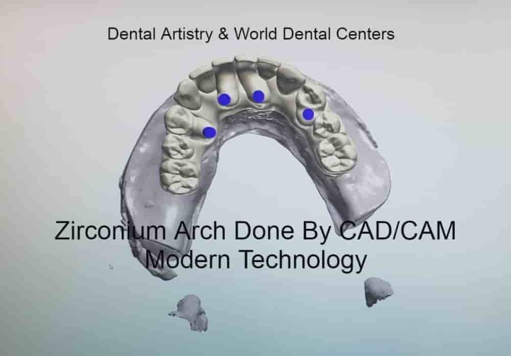 Dental Artistry & World Dental Center in Nuevo Progreso, Mexico Reviews from Real Patients Slider image 8