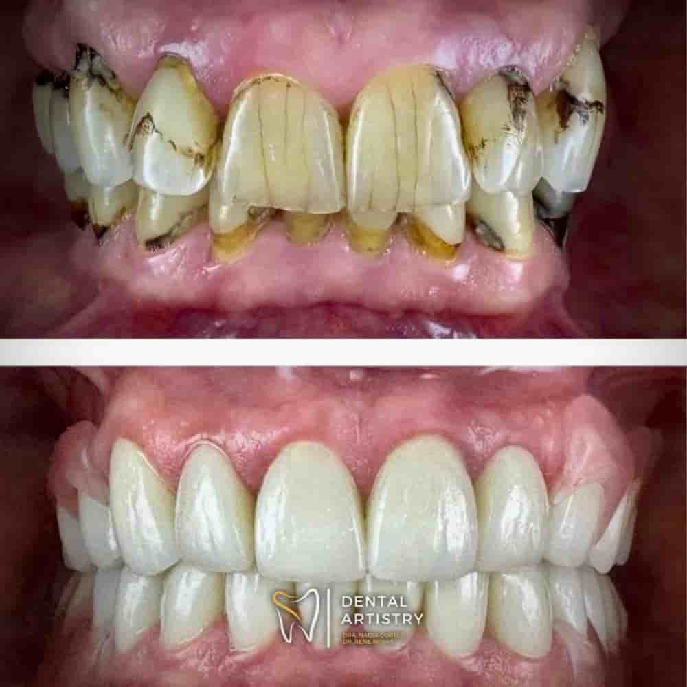 Dental Artistry & World Dental Center in Nuevo Progreso, Mexico Reviews from Real Patients Slider image 1