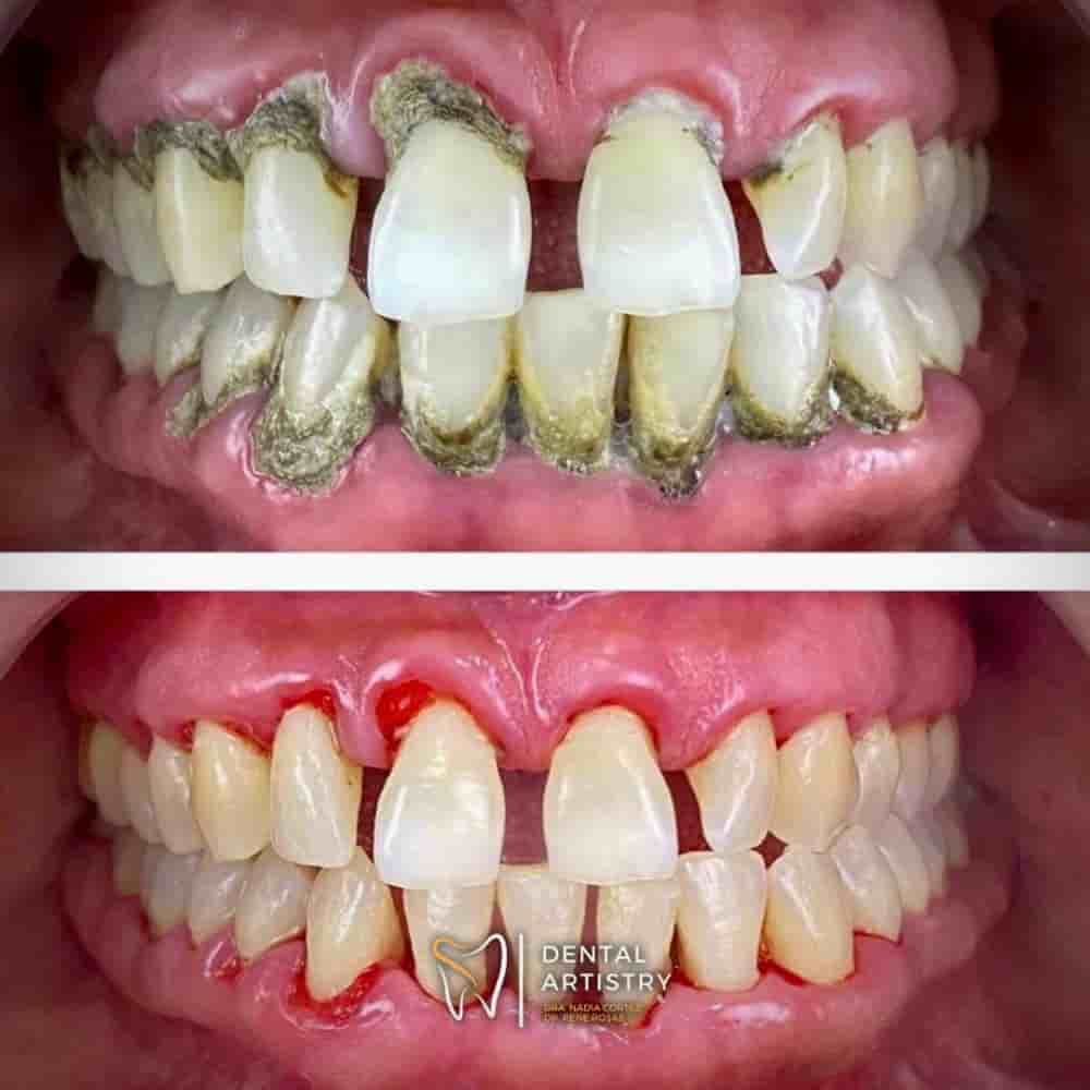 Dental Artistry & World Dental Center in Nuevo Progreso, Mexico Reviews from Real Patients Slider image 2
