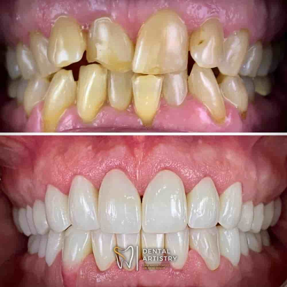 Dental Artistry & World Dental Center in Nuevo Progreso, Mexico Reviews from Real Patients Slider image 3