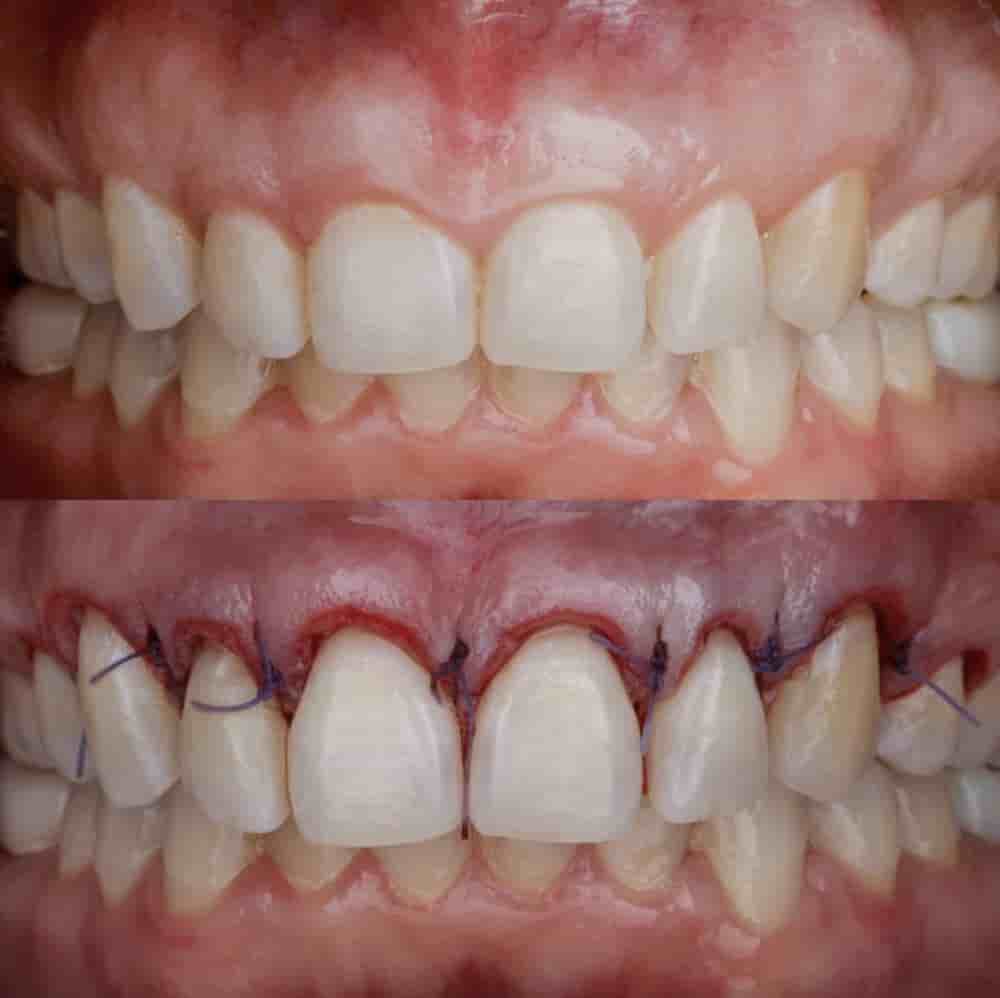 Easy Dental Reviews in Los Algodones, Mexico Slider image 4