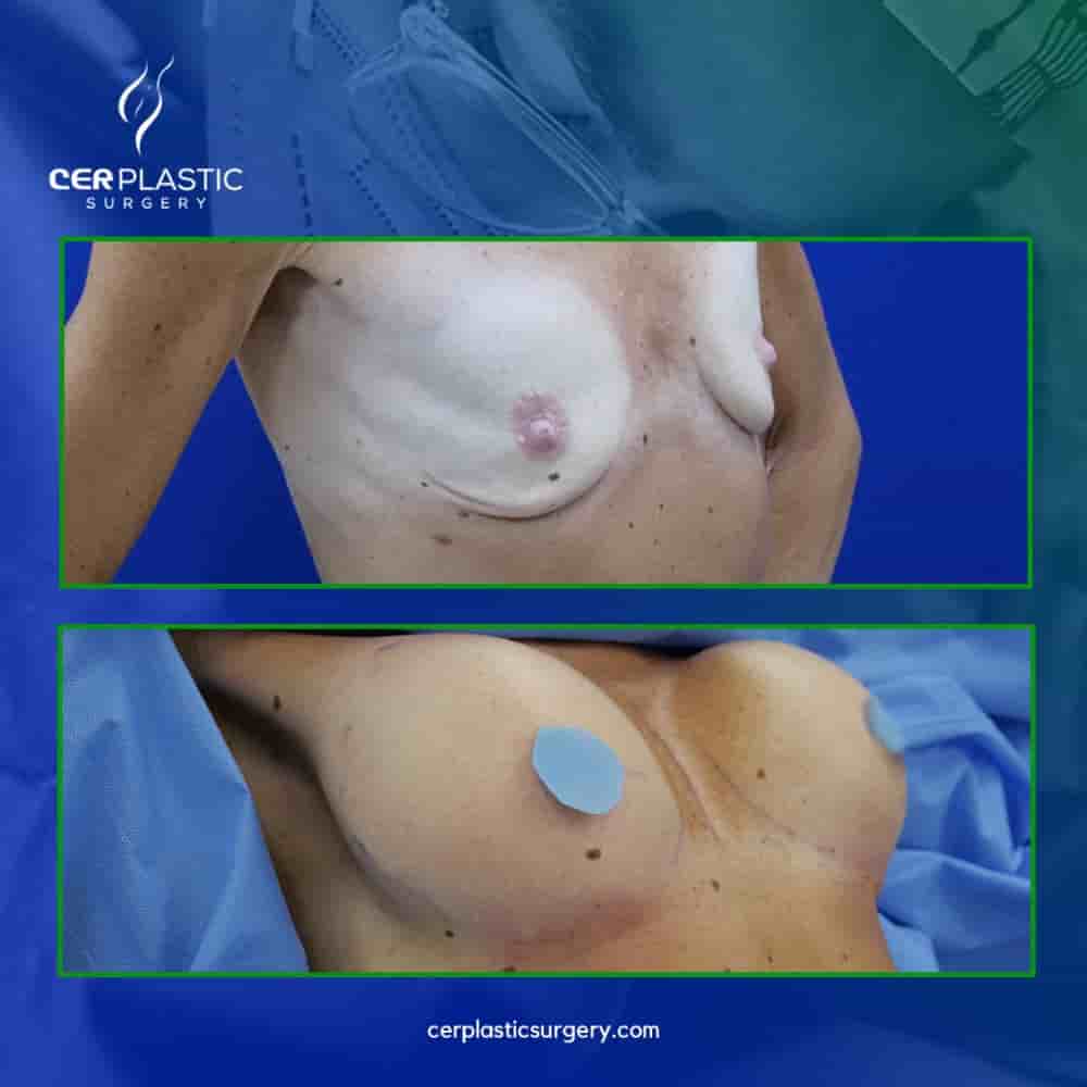CER Hospital Reviews in Tijuana Mexico from Real Bariatric & Aesthetic Patients  Slider image 8
