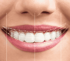 Sanart Dental Studio in Tirana, Albania Reviews From Dental Treatment Patients Slider image 2