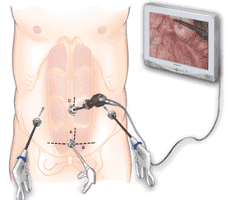 Verified Patient Reviews of Hurghada Surgery in Hurghada, Egypt Slider image 3